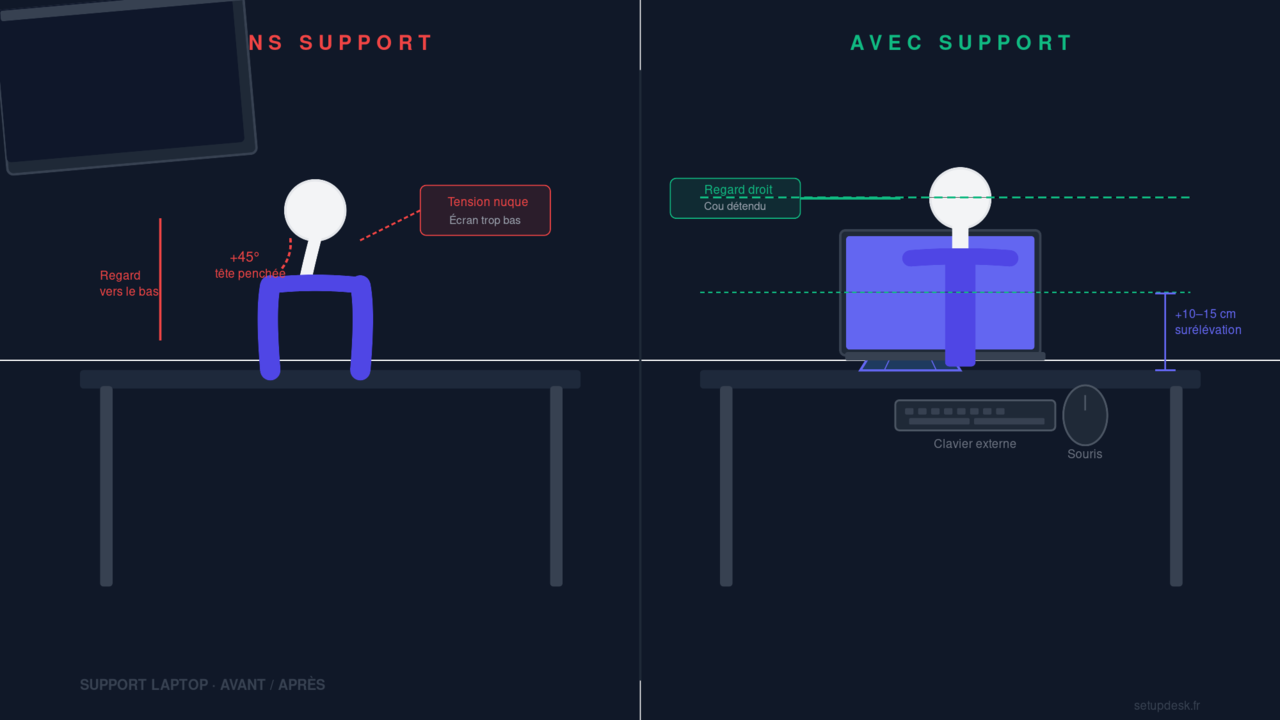 Support laptop : comparaison posture avec et sans surélévation – SetupDesk